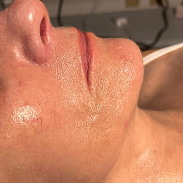 6-visit Facial Series at Tiana Marie Esthetics in Redmond, WA